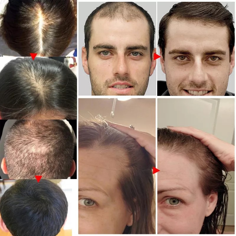 2023 Biotin Fast Hair Growth O - Licorice Root Sticks ulasan dan harga