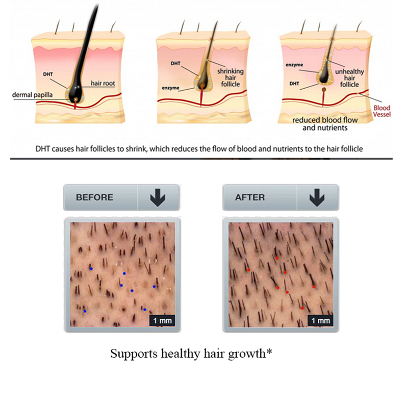 PURC 100ml Ginger Hair Loss Sh - Licorice Root Sticks ulasan dan harga